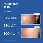 10% Niacinamide & Rice Water Brightening Face Serum